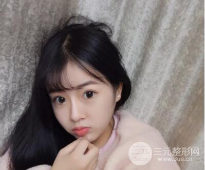 我的自體脂肪面部填充日記