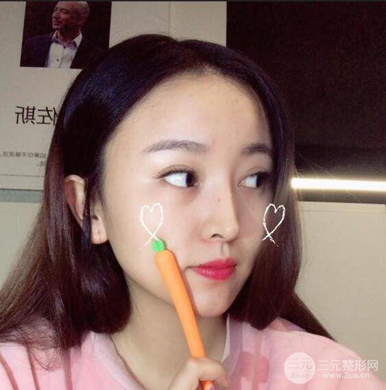 珠海陸達(dá)彭劍隆鼻整形術(shù)前術(shù)后對(duì)比