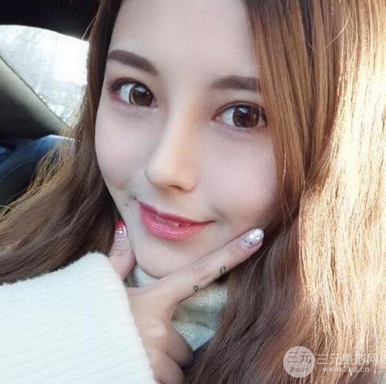 杭州恒顏醫(yī)療美容趙德星肋軟骨隆鼻術(shù)后六十天全記錄