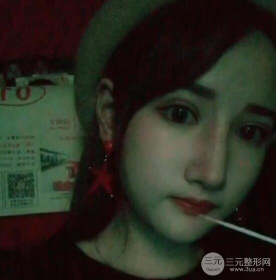 去下頜角+顴骨內(nèi)推手術(shù)三個月記錄，看大臉妹如何逆襲