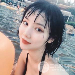 全切雙眼皮半個(gè)月恢復(fù)全記錄