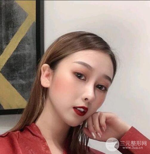 三亞三仁于德印肋軟骨隆鼻+硅膠墊下巴恢復(fù)對(duì)比圖