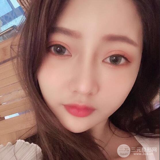 只是做了隆鼻整形改變居然辣么大，快來看看我的隆鼻整形恢復(fù)日記叭