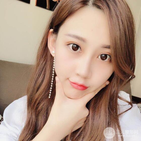 割雙眼皮兩個(gè)月是啥樣，妹子公開恢復(fù)記錄