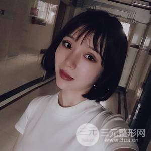 全切雙眼皮半個(gè)月恢復(fù)全記錄