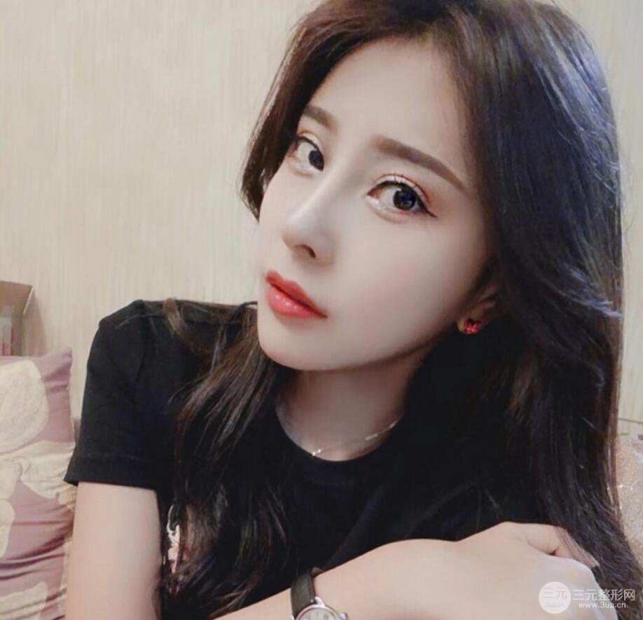 青島海倫整形朱洪濤肋軟骨隆鼻恢復(fù)記錄