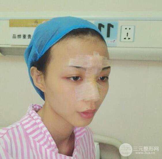 凸嘴先別急著正頜，做個(gè)隆鼻整形會(huì)更美