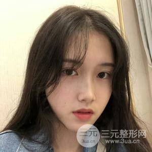 北京藝星仇侃敏肋軟骨隆鼻真實果對比圖