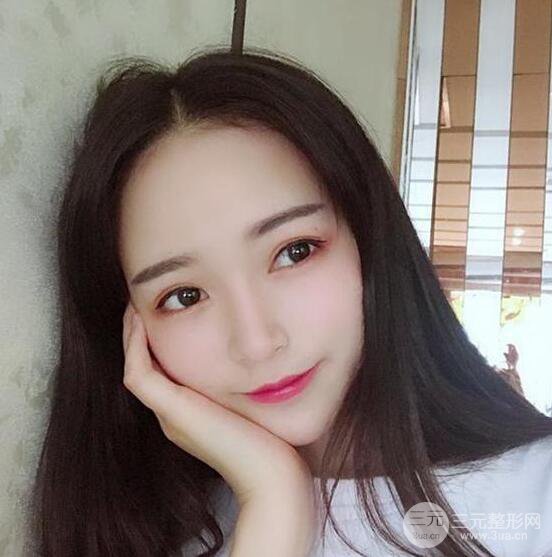 銀川崔大夫博士麗醫(yī)療美容朱杰膨體隆鼻果反饋