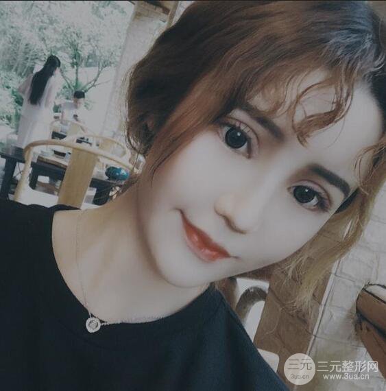 原來(lái)我和baby的距離只差一個(gè)網(wǎng)紅套餐，“雙眼皮+自體脂肪填充+豐唇”術(shù)后真人反饋