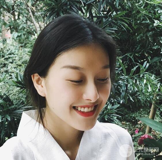 做了“埋埋蛋白線.提升+隆鼻整形”，恢復(fù)后老公說很沒有降低風(fēng)險(xiǎn)感