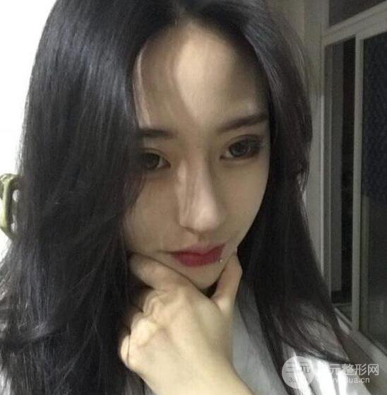 河南中醫(yī)藥大學(xué)第(一)附屬醫(yī)院趙絳波做磨骨怎么樣？看看這位小姐姐的蛻變叭！