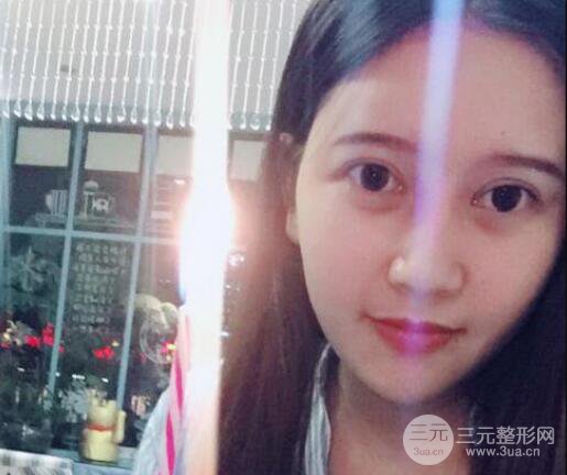 宜昌美岸醫(yī)療美容李英華自體脂肪面部填充怎么樣？真人日記曝光