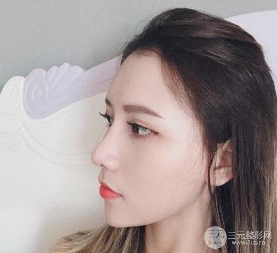 隆鼻整形手術(shù)三個(gè)月后真人果圖