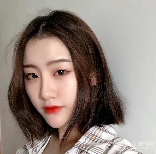 膨體隆鼻三十天恢復(fù)記錄，術(shù)前術(shù)后對(duì)比圖片曝光