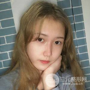 北京藝星仇侃敏肋軟骨隆鼻真實果對比圖