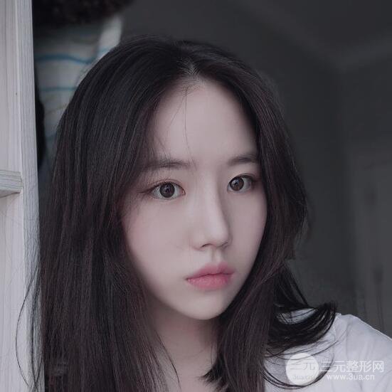 上海華美醫(yī)療美容李庭勛膨體隆鼻怎么樣？果對比圖