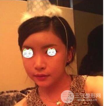 談一談我的磨骨瘦臉經(jīng)歷