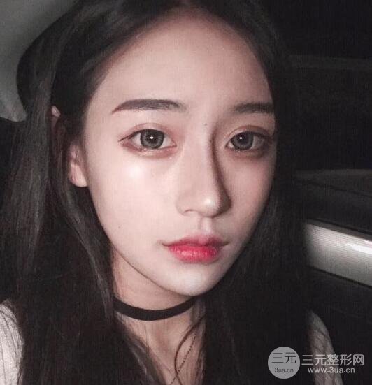 河南中醫(yī)藥大學(xué)第(一)附屬醫(yī)院趙絳波做磨骨怎么樣？看看這位小姐姐的蛻變叭！