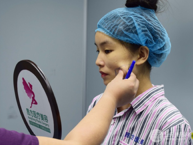 埋埋蛋白線.提升恢復圖，原來小V臉不一定要磨骨