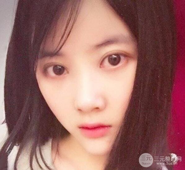 墊下巴恢復(fù)日記