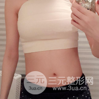 自體脂肪隆胸恢復(fù)圖曝光，見證從A到C的蛻變