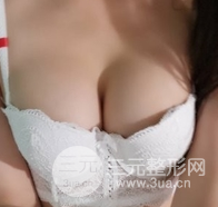 自體脂肪隆胸恢復(fù)圖曝光，見證從A到C的蛻變