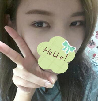 一起來評價一下重慶愛思特盧剛醫(yī)生做的切開雙眼皮吧