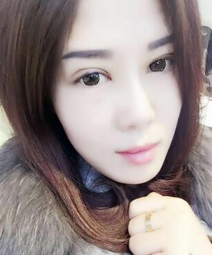 雙眼皮恢復(fù)記錄 果很滿意~