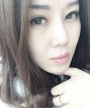 雙眼皮恢復(fù)記錄 果很滿意~