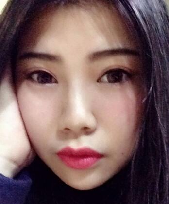 全切雙眼皮后 走向女神之路