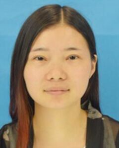 張中鋒做的隆鼻整形真的精致漂亮