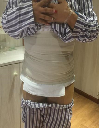 給你們分享麗都醫(yī)生做的吸脂瘦腰腹