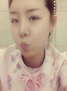 陳萬芳醫(yī)生做的自體脂肪填充面部后變得超年輕