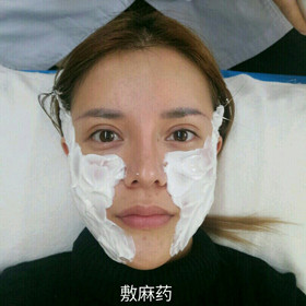 埋蛋白線.提升面部對比圖片，顏值嘩嘩嘩的往上漲!!!