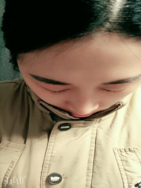 于立民醫(yī)生給我做的隆鼻整形手術(shù)，給大家分享我整形的過程吧!