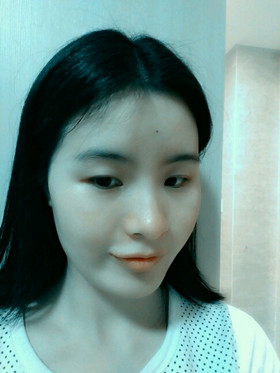 自體脂肪填充下巴前后對比圖，進來看看就知道啦!