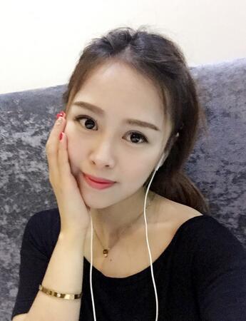 切開(kāi)雙眼皮恢復(fù)過(guò)程 心路分享~