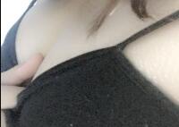 假體隆胸整形經(jīng)歷分享