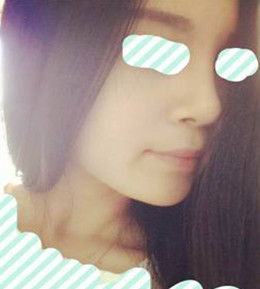 藝美門智和綜合隆鼻，你值得擁有