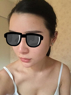 藝美王東做的自體脂肪填充面部，要的就是這個(gè)范兒