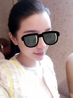 藝美王東做的自體脂肪填充面部，要的就是這個(gè)范兒