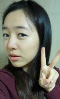 耳軟骨隆鼻前后過(guò)程圖片，見證我變美的過(guò)程