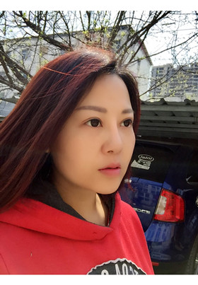 自體脂肪填充面部前后對比圖片，真的美了美了!