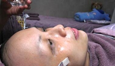 成都玉之光做了杏仁酸換膚 皮膚真的凈白無(wú)瑕了