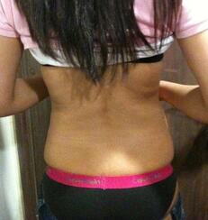 北京禾美嘉腹部吸脂 可以自信地秀出小蠻腰啦！