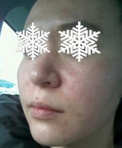 北京禾美嘉彩光嫩膚 果不錯哦~