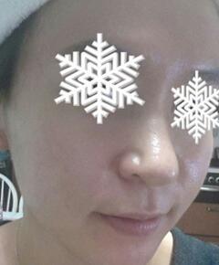 北京禾美嘉彩光嫩膚 果不錯哦~