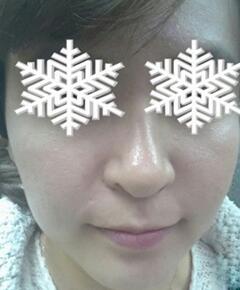 北京禾美嘉彩光嫩膚 果不錯哦~