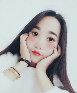 煙臺鵬愛魏璐做的全切雙眼皮，我也是大眼美女了